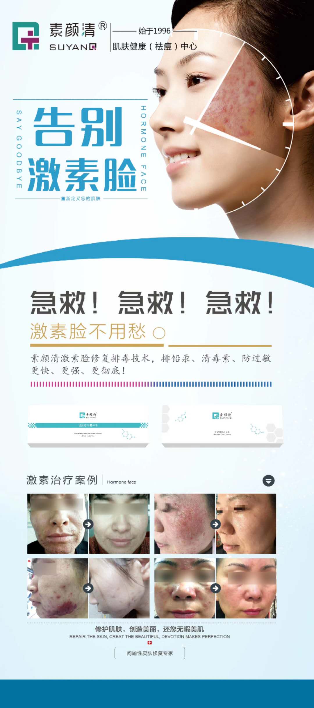 近两年未工作，只为治好激素脸。潍坊祛痘(图1)